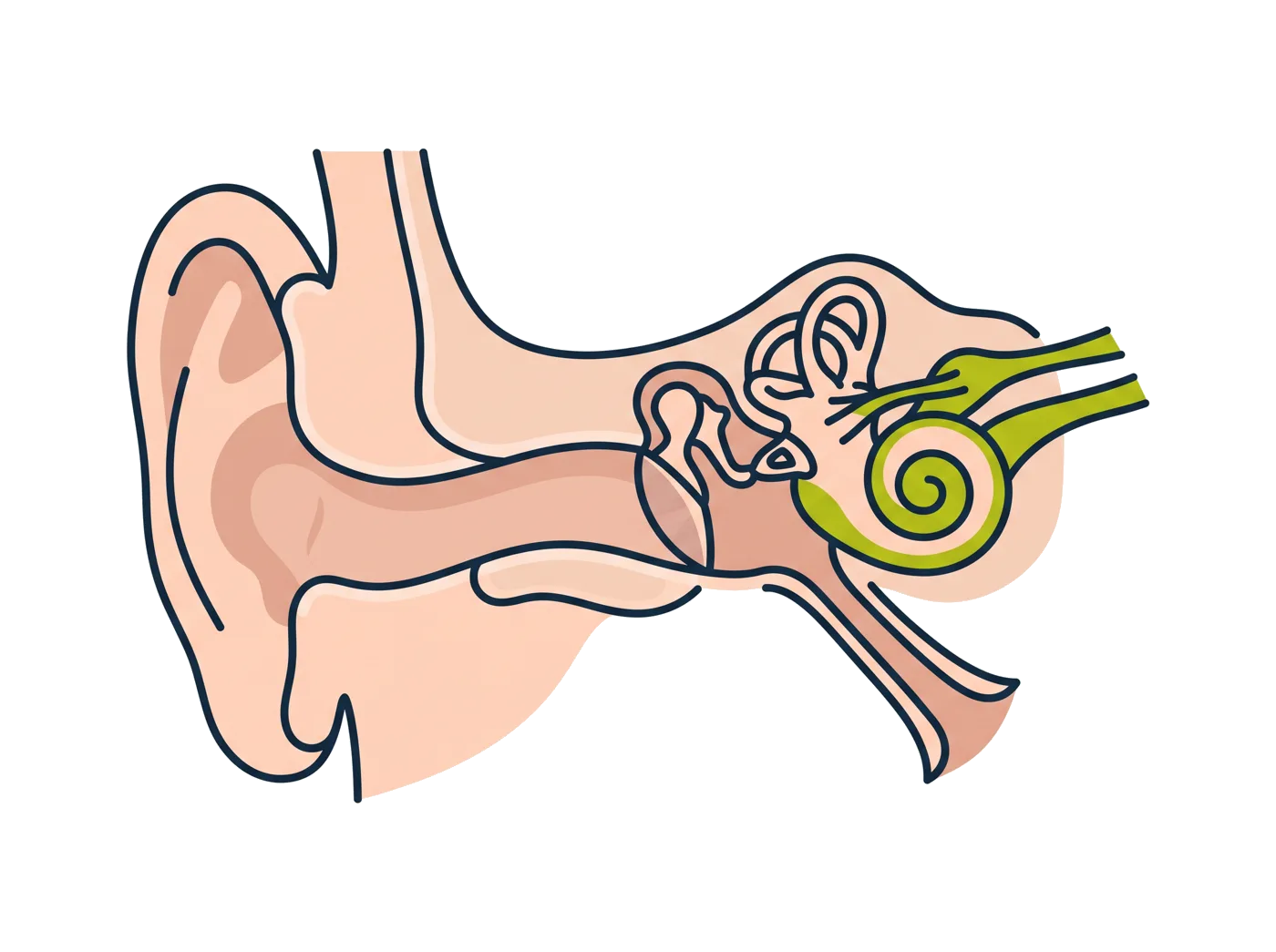 A cross-section of the human ear showing the outer ear, ear canal, ear drum, the three small bones of the middle ear, the cochlea and the auditory nerve.