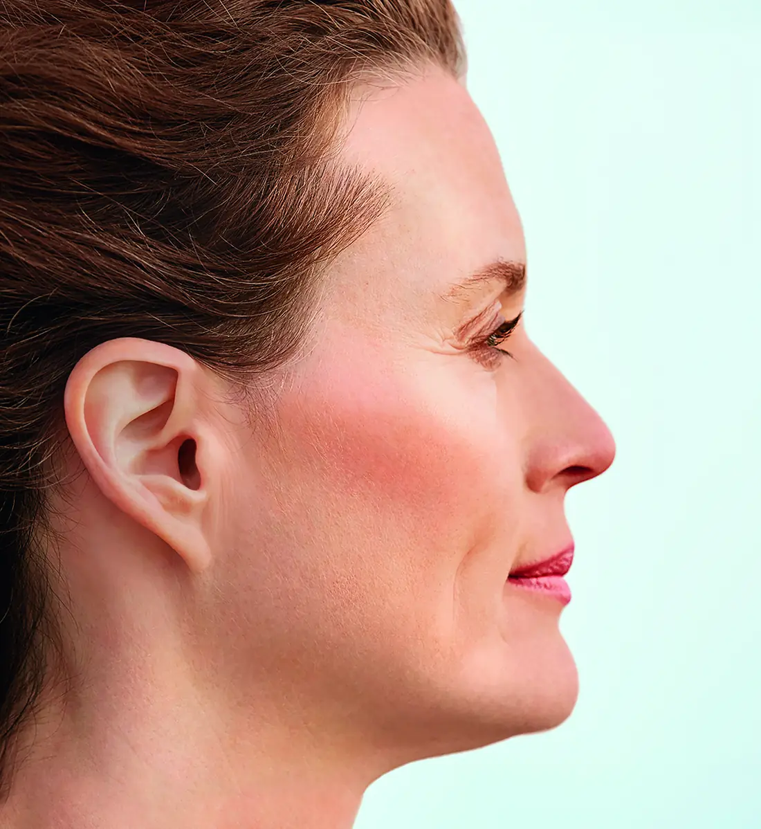 A woman in profile wearing Phonak Lyric, with nothing visible in or behind her ear.